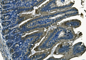 PI-16/PI16/PI Rabbit Polyclonal Antibody