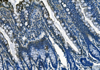 PI-16/PI16/PI Rabbit Polyclonal Antibody