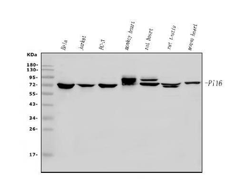 PI-16/PI16/PI Rabbit Polyclonal Antibody