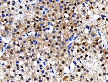 TBP-1/PSMC3 Antibody