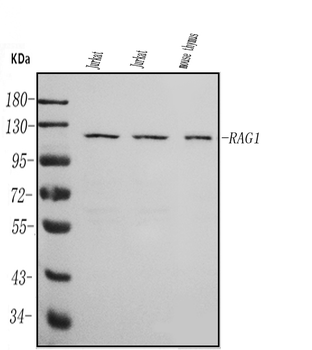 RAG1 Rabbit Polyclonal Antibody