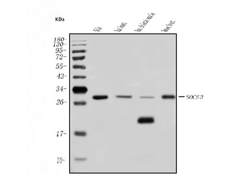 SOCS3 Rabbit Polyclonal Antibody