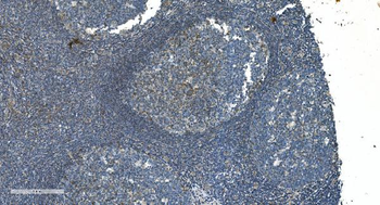 TIMM8A/DDP Rabbit Polyclonal Antibody
