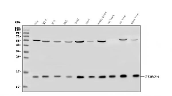 TIMM8A/DDP Rabbit Polyclonal Antibody
