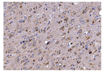 TIMM8A/DDP Rabbit Polyclonal Antibody