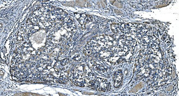 TIMM8A/DDP Rabbit Polyclonal Antibody