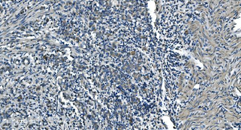 TIMM8A/DDP Rabbit Polyclonal Antibody