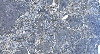 TIMM8A/DDP Rabbit Polyclonal Antibody