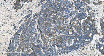 TIMM8A/DDP Rabbit Polyclonal Antibody