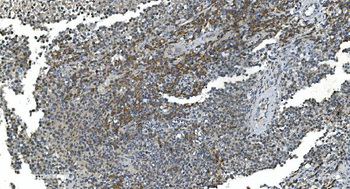 TIMM8A/DDP Rabbit Polyclonal Antibody
