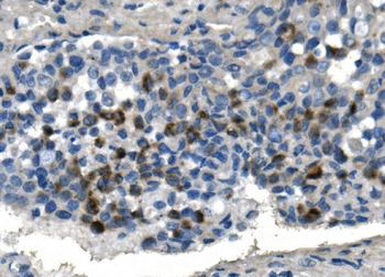 TMPRSS3 Rabbit Polyclonal Antibody