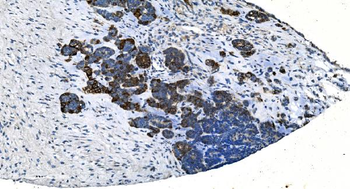 TMPRSS3 Rabbit Polyclonal Antibody
