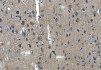TMPRSS3 Rabbit Polyclonal Antibody