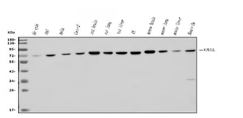 N WASP/WASL Rabbit Polyclonal Antibody