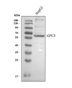 Glypican 3/GPC3 Rabbit Polyclonal Antibody