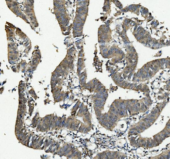 ANAPC2 Rabbit Polyclonal Antibody