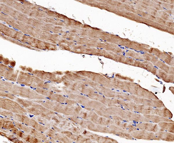 CACNA1S Rabbit Polyclonal Antibody