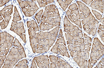 CACNA1S Rabbit Polyclonal Antibody
