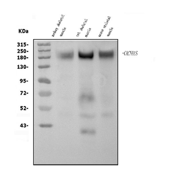CACNA1S Rabbit Polyclonal Antibody