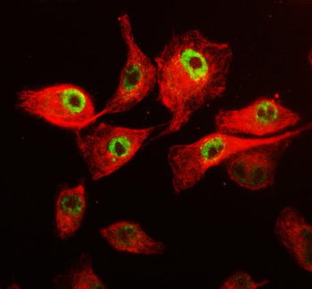 CDK12 Rabbit Polyclonal Antibody