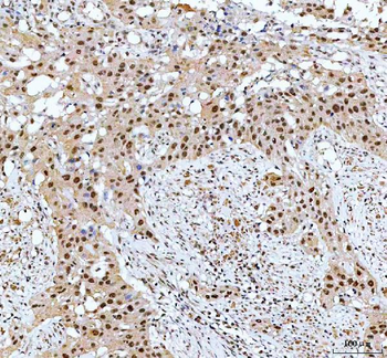 CDK12 Rabbit Polyclonal Antibody