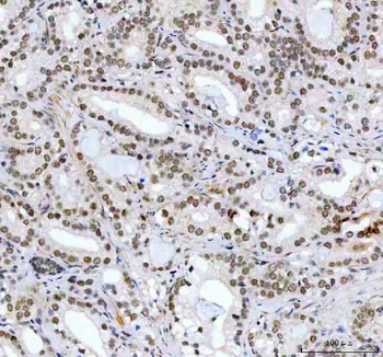CDK12 Rabbit Polyclonal Antibody