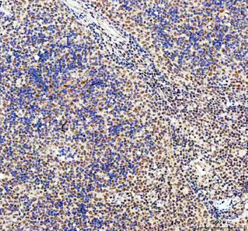 CDK12 Rabbit Polyclonal Antibody