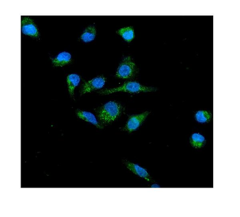 NOX2/gp91phox/CYBB Rabbit Polyclonal Antibody