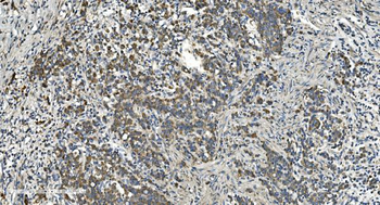 NOX2/gp91phox/CYBB Rabbit Polyclonal Antibody