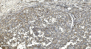 NOX2/gp91phox/CYBB Rabbit Polyclonal Antibody