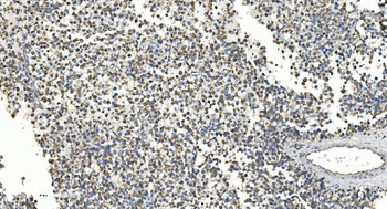 NOX2/gp91phox/CYBB Rabbit Polyclonal Antibody