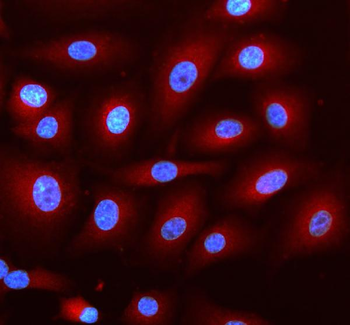 DNAJC6 Rabbit Polyclonal Antibody