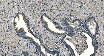 DNAJC10 Antibody