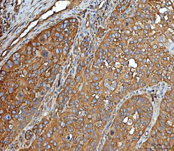 EEF2 Rabbit Polyclonal Antibody