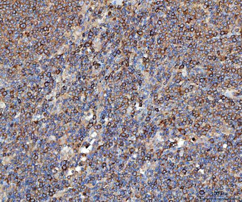 EEF2 Rabbit Polyclonal Antibody