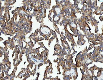 EEF2 Rabbit Polyclonal Antibody
