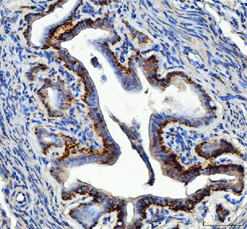 EEF2 Rabbit Polyclonal Antibody