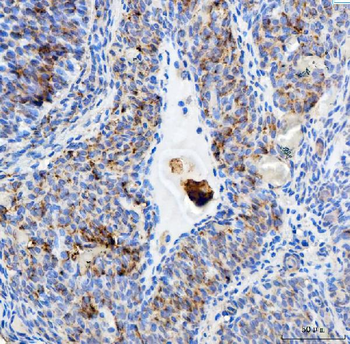 EEF2 Rabbit Polyclonal Antibody
