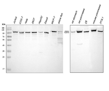 EEF2 Rabbit Polyclonal Antibody