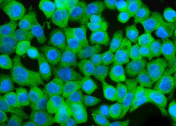 GCHFR Rabbit Polyclonal Antibody