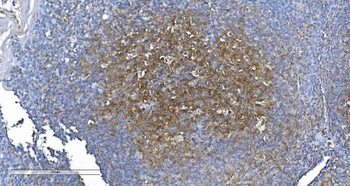 GCHFR Rabbit Polyclonal Antibody