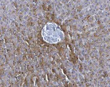 GCHFR Rabbit Polyclonal Antibody