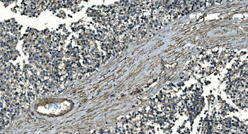 GNG7 Rabbit Polyclonal Antibody