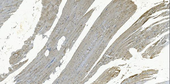GSTA4 Rabbit Polyclonal Antibody
