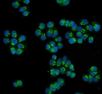HOXC13 Rabbit Polyclonal Antibody