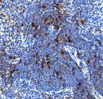 IL4R Rabbit Polyclonal Antibody