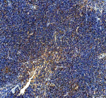 IL10 Rabbit Polyclonal Antibody