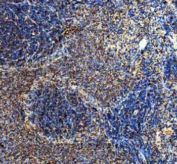 IL10 Rabbit Polyclonal Antibody