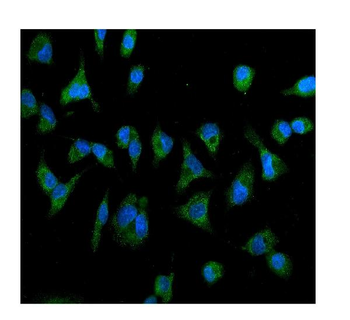 IL2 Receptor beta/p75/IL2RB Antibody