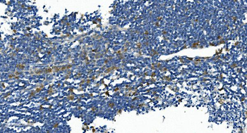 IL2 Receptor beta/p75/IL2RB Antibody